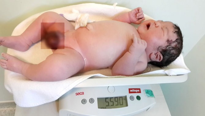 5kilo 590 gram Doğan Bebek Şaşırttı