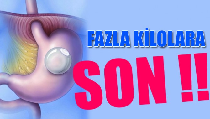 Ameliyatsız Mide Balonu İle Kilo Fazlalığına Son