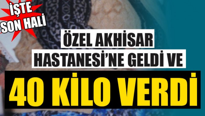 Özel Akhisar Hastanesi’ne Geldi, 40 Kilo Verdi