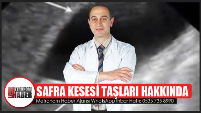 Safra Kesesi Taşları Hakkında