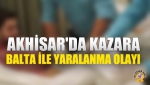 Akhisar'da Kazara Balta İle Yaralanma Olayı