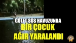 Gölet Süs Havuzunda Bir Çocuk Ağır Yaralandı